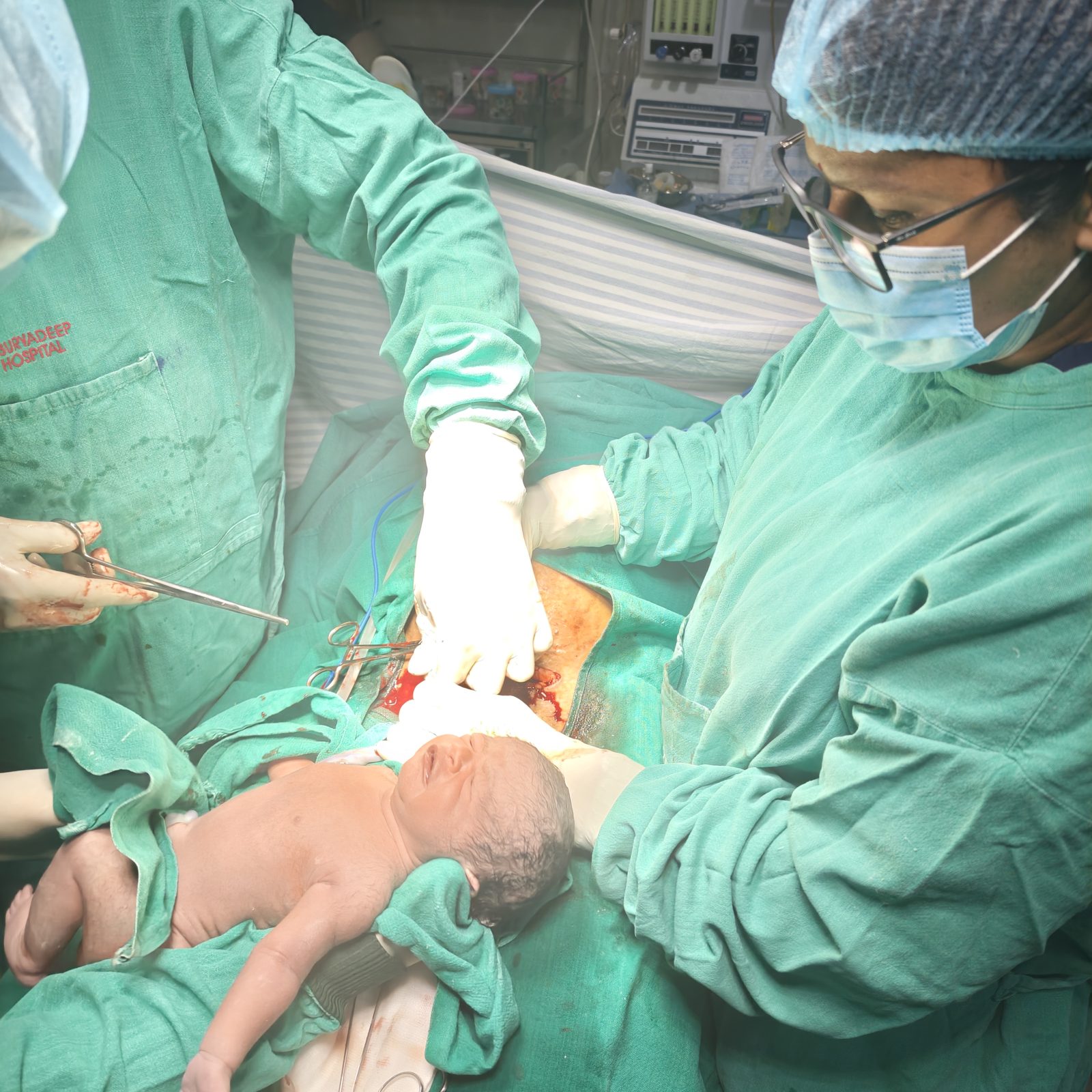 Delivery moment in operation theatre