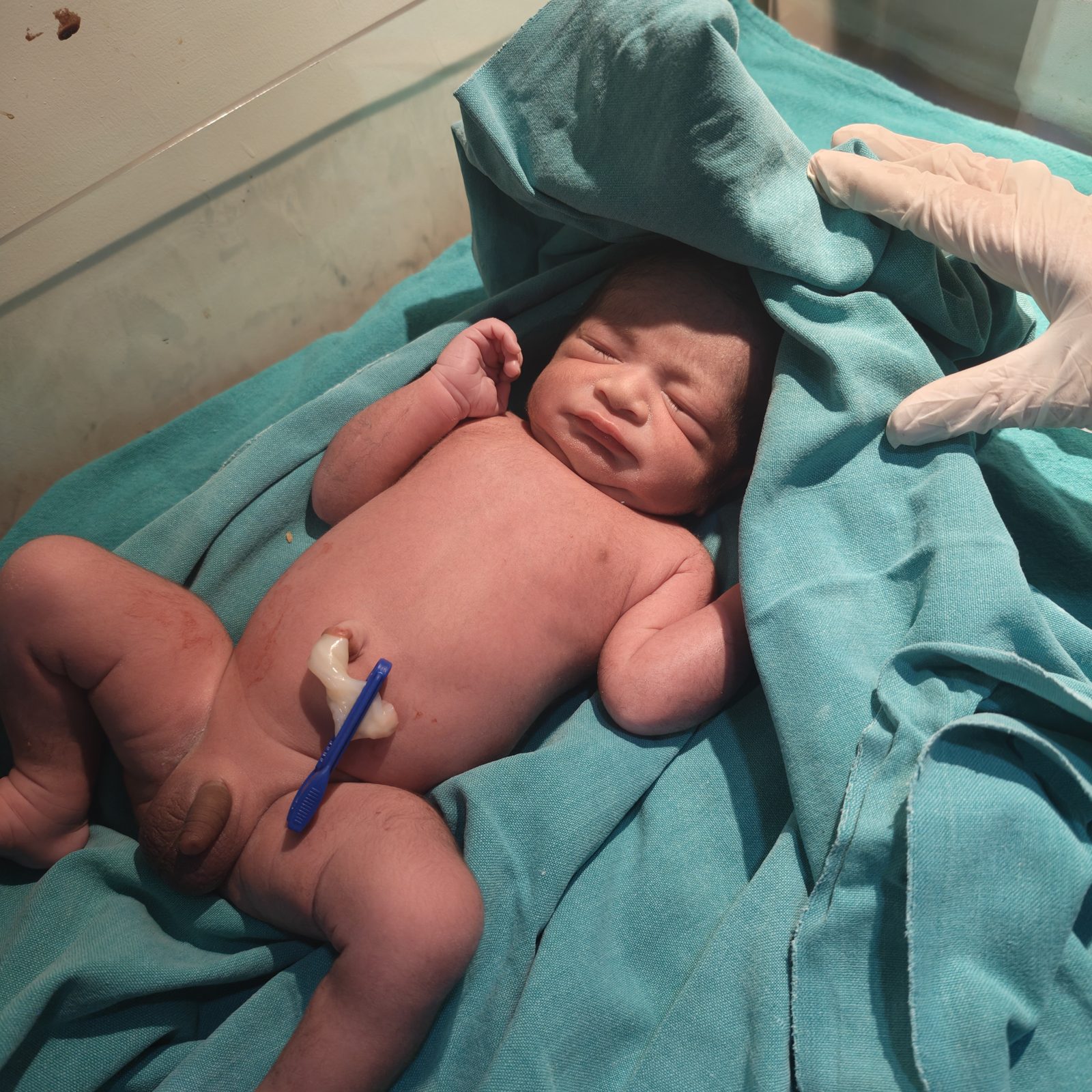 Newborn baby just delivered