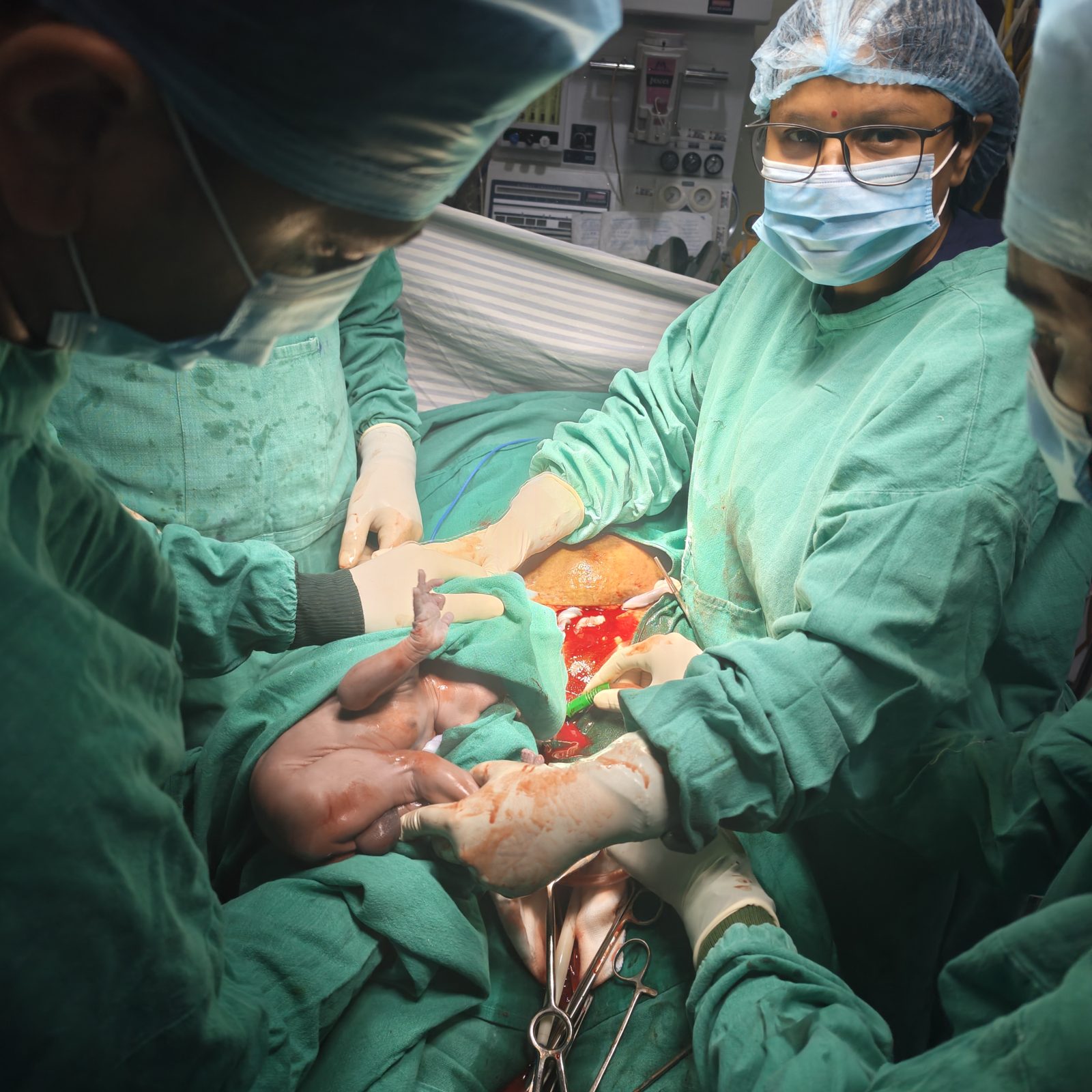 Twin delivery in operation theatre